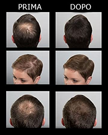 HAIR SCULPTOR 25g Polvere per calvizie SIBEL – Buizza - HAIR & BEAUTY  FORNITURE